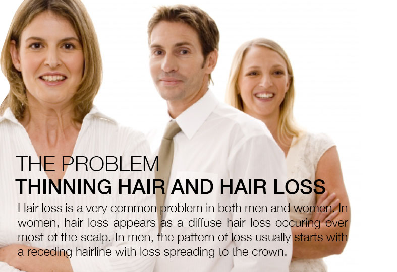 Nutrigrow What Is The Differences Between Man And Women Hair Loss